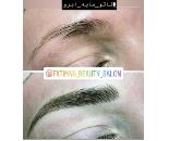 بهترین مرکز فیبروز سهروردی